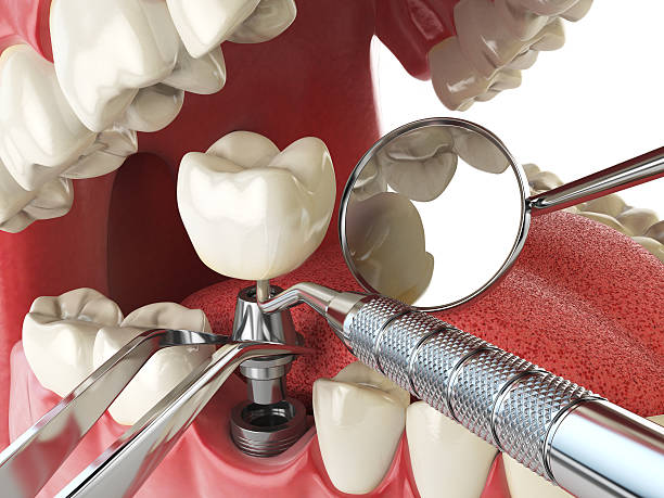 Best Emergency Gum Pain Relief  in Lower Grand Lagoon, FL